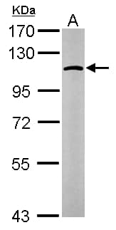GANAB / Alpha Glucosidase II Antibody (aa47-251)
