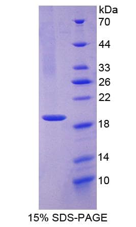 Rat MPO / Myeloperoxidase Protein (Recombinant His-T7)