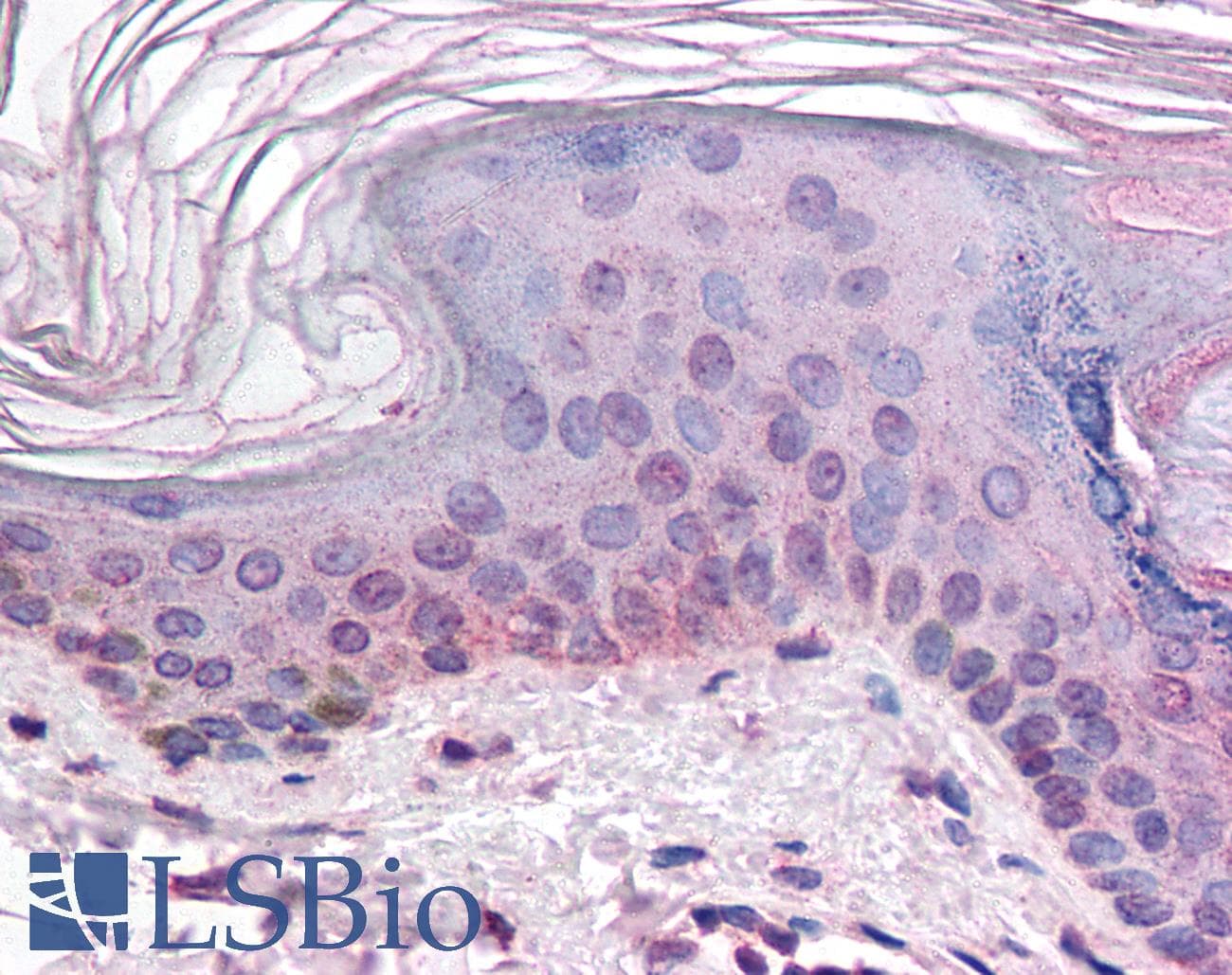 IHC-plus™ ARNT / HIF-1-Beta Antibody (aa496-789)