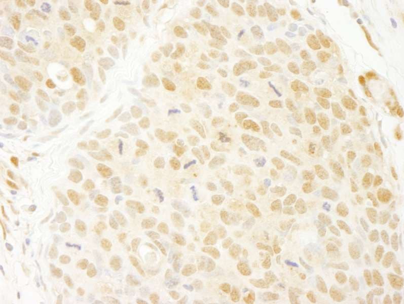 ANKRD17 Antibody (aa1550-1600)
