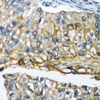 Polyclonal Rabbit anti-Human POTEG Antibody (IHC, WB)