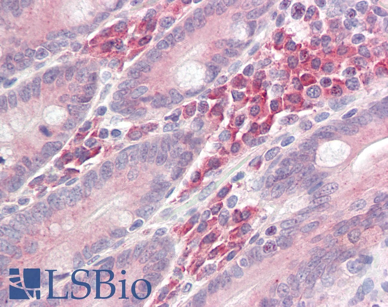 IHC-plus™ LAT Antibody (aa70-120)