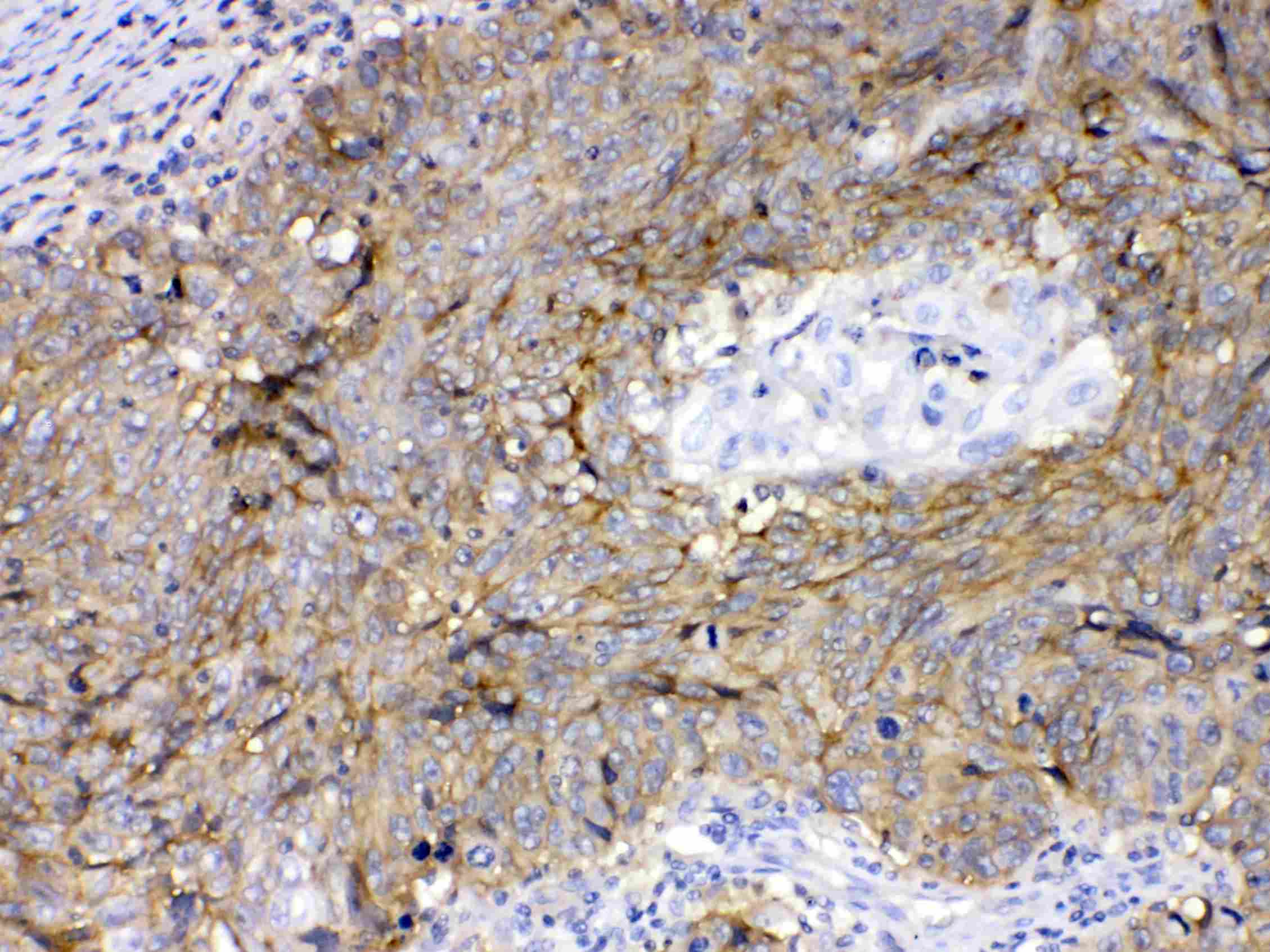 Basigin / Emmprin / CD147 Antibody