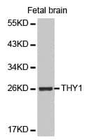 Polyclonal Rabbit anti-Human THY1 / CD90 Antibody (IHC, WB)