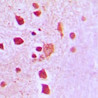 PRDX3 / Peroxiredoxin 3 Antibody (Internal)
