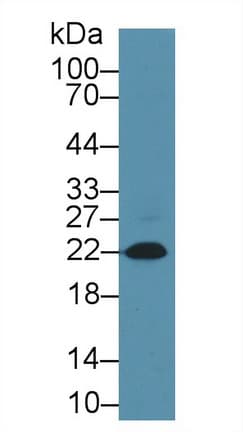 NT-proBNP Antibody (APC)