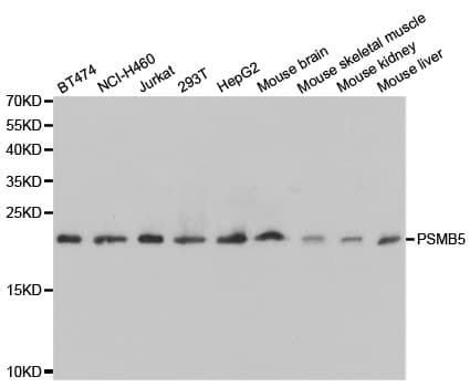 IHC-plus™ PSMB5 Antibody