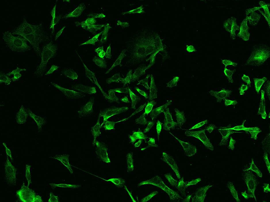 RAB5IF Antibody