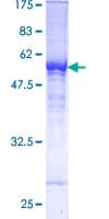 Human TFPI / LACI Protein (Recombinant GST)