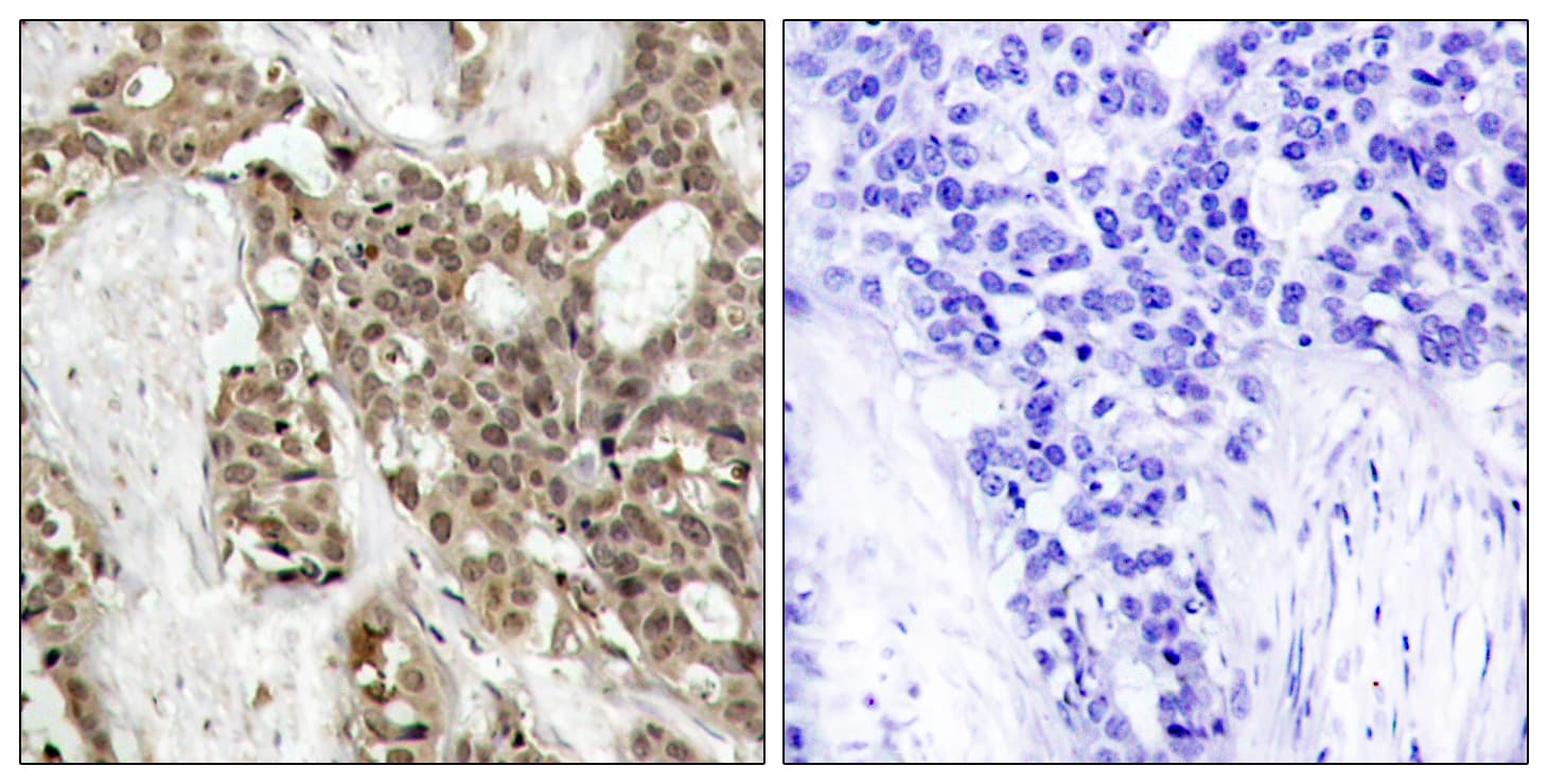 ERK1 + ERK2 Antibody (phospho-Tyr204)