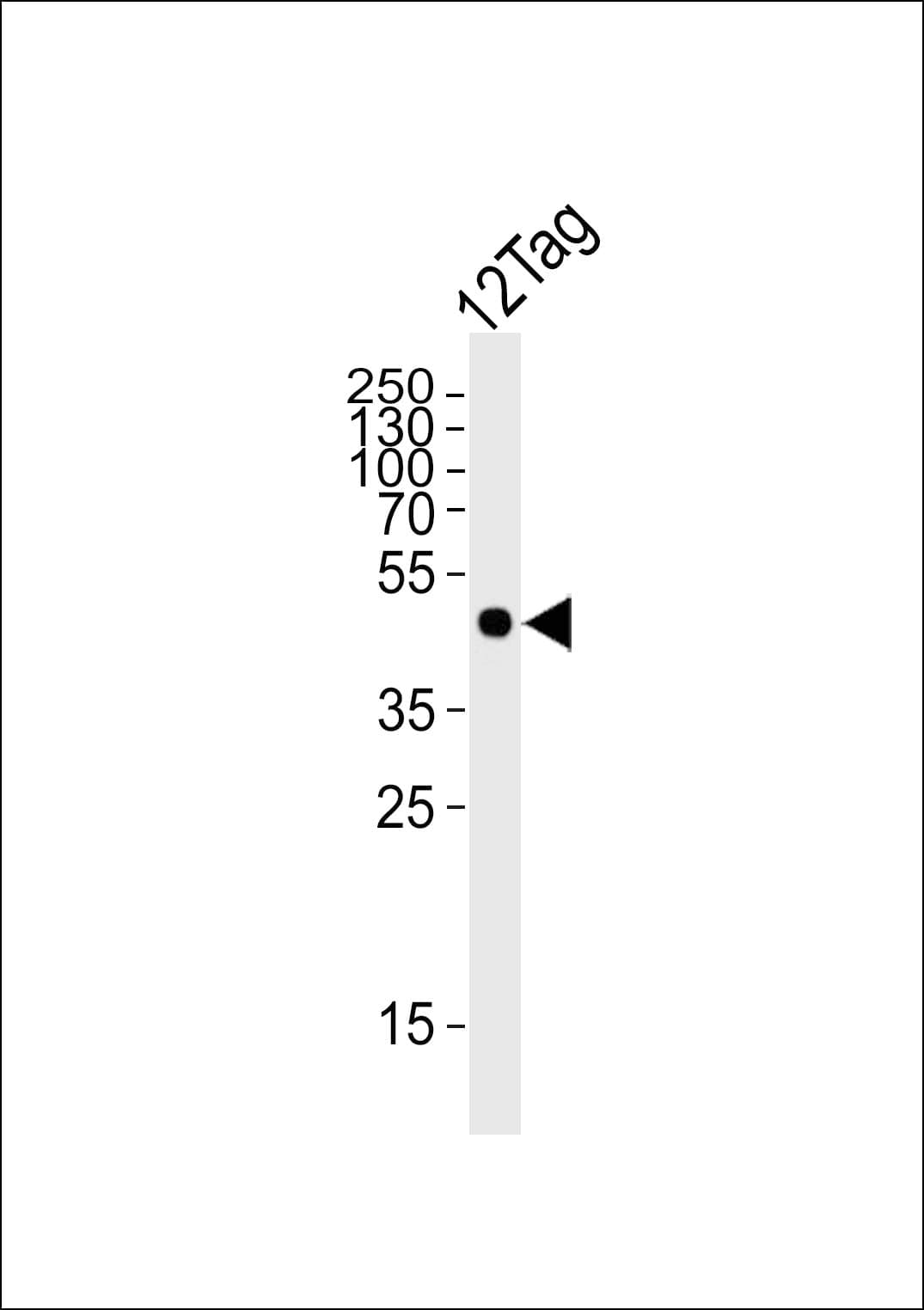 His Tag Antibody