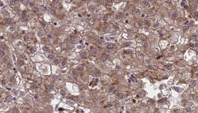 OR1G1 Antibody