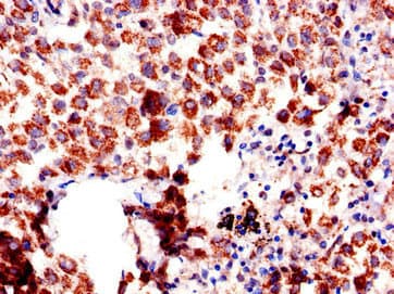 AQP6 / Aquaporin 6 Antibody