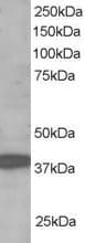 IHC-plus™ RNF39 Antibody (aa407-420)