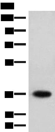HOXC12 Antibody