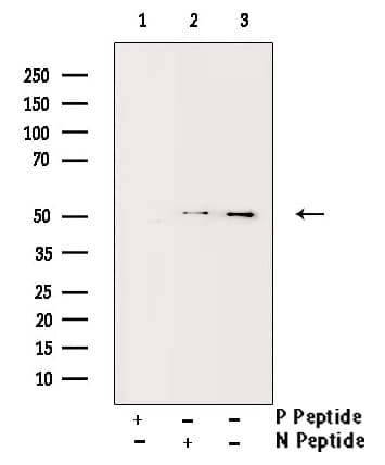BLNK Antibody (phospho-Tyr96)