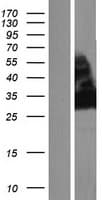 NT5C3B / NT5C3L Protein (Over-Expression Lysate Myc-DDK (Flag))