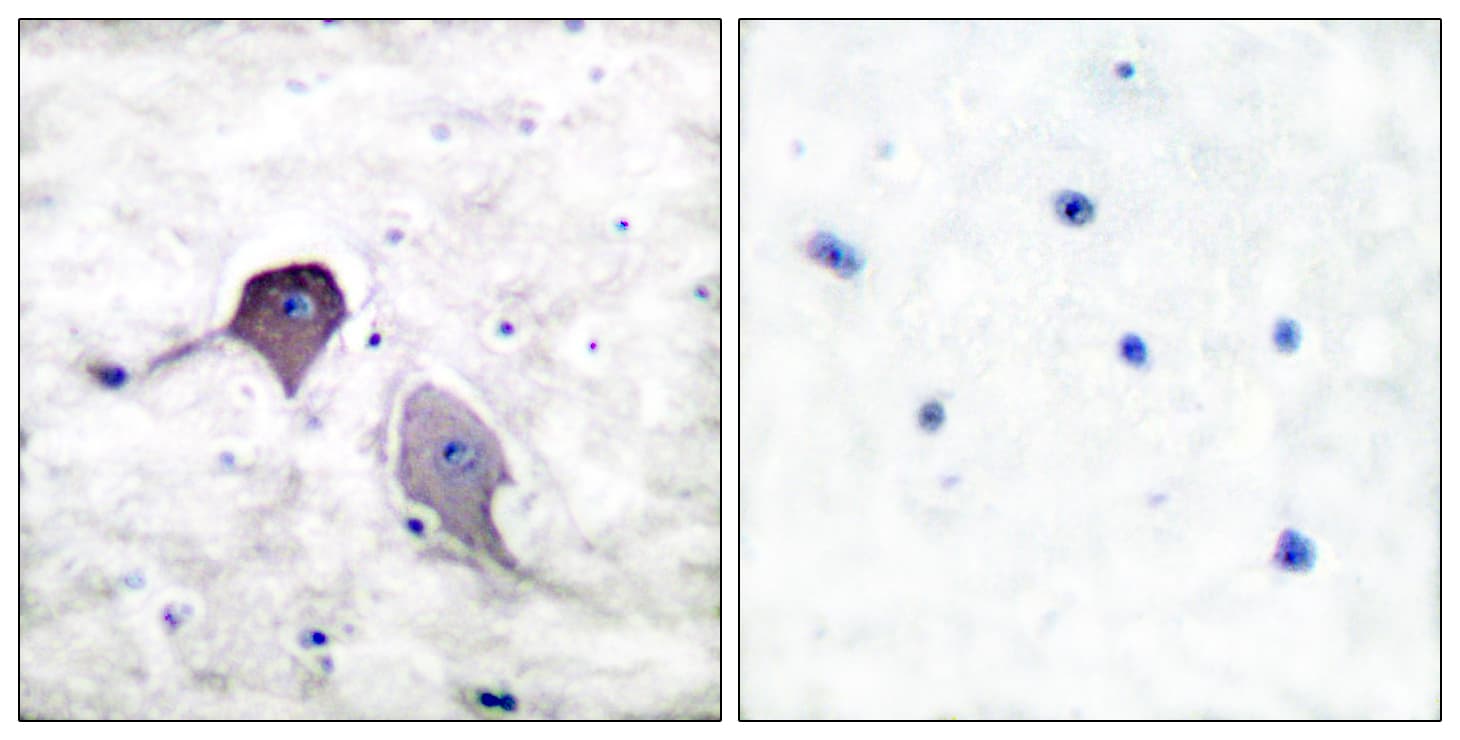 PSEN1 / Presenilin 1 Antibody (aa1-50)