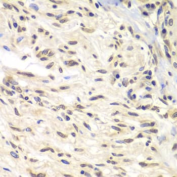 CHEK1 / CHK1 Antibody