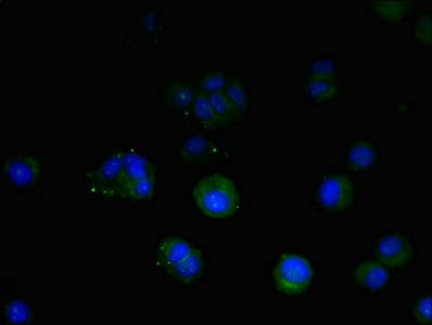 Polyclonal Rabbit anti-Human TM9SF1 Antibody (IHC, IF, WB)