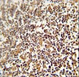NRROS / LRRC33 Antibody (aa611-640)