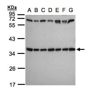 RPS3A / Ribosomal Protein S3A Antibody (aa14-264)