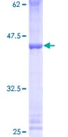 Human ZNF93 Protein (Recombinant GST)