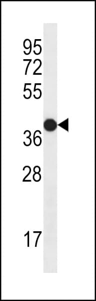 NGFR / CD271 / TNR16 Antibody (aa353-380)