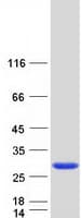 Human CRYBA2 Protein (Recombinant Myc-DDK (Flag))