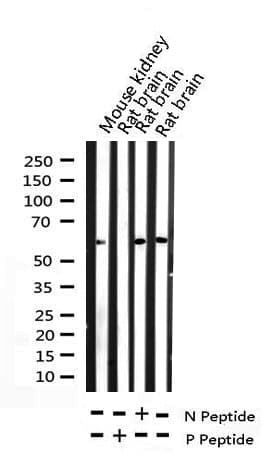 MYC / c-Myc Antibody (phospho-Thr58)