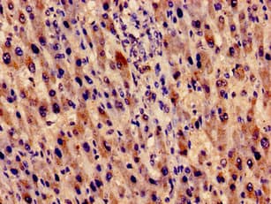 Polyclonal Rabbit anti-Human EVC / DWF-1 Antibody (IHC, WB)