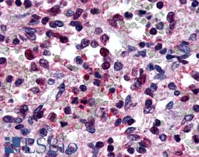 PathPlus™ P2RY6 / P2Y6 Antibody (C-Terminus)