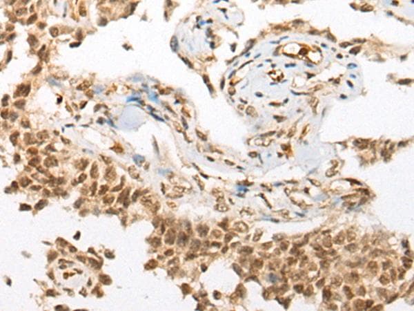DRPLA / Atrophin-1 Antibody