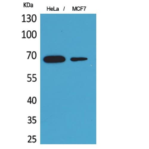 PCK1 Antibody (Internal)