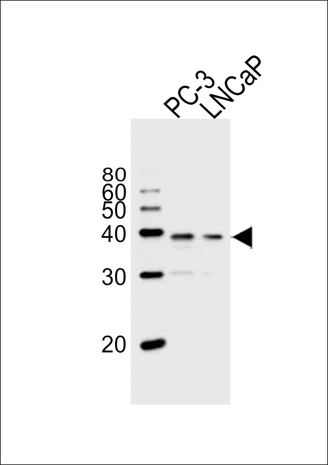 Polyclonal Rabbit anti-Human Vitamin D Receptor / VDR Antibody (aa274-299, WB)