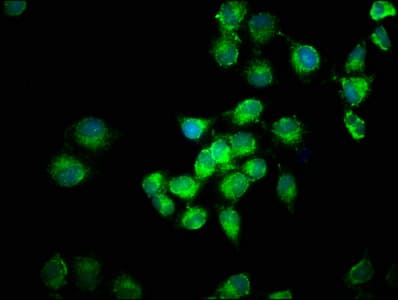 Polyclonal Rabbit anti-Human FGF1 / Acidic FGF Antibody (aa16-155, IHC)