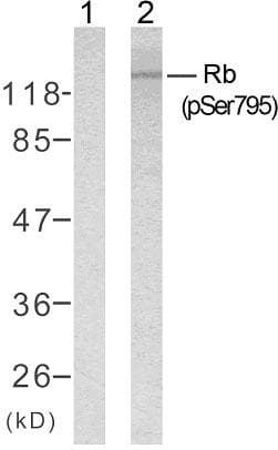 RB1 / Retinoblastoma / RB Antibody (phospho-Ser795)
