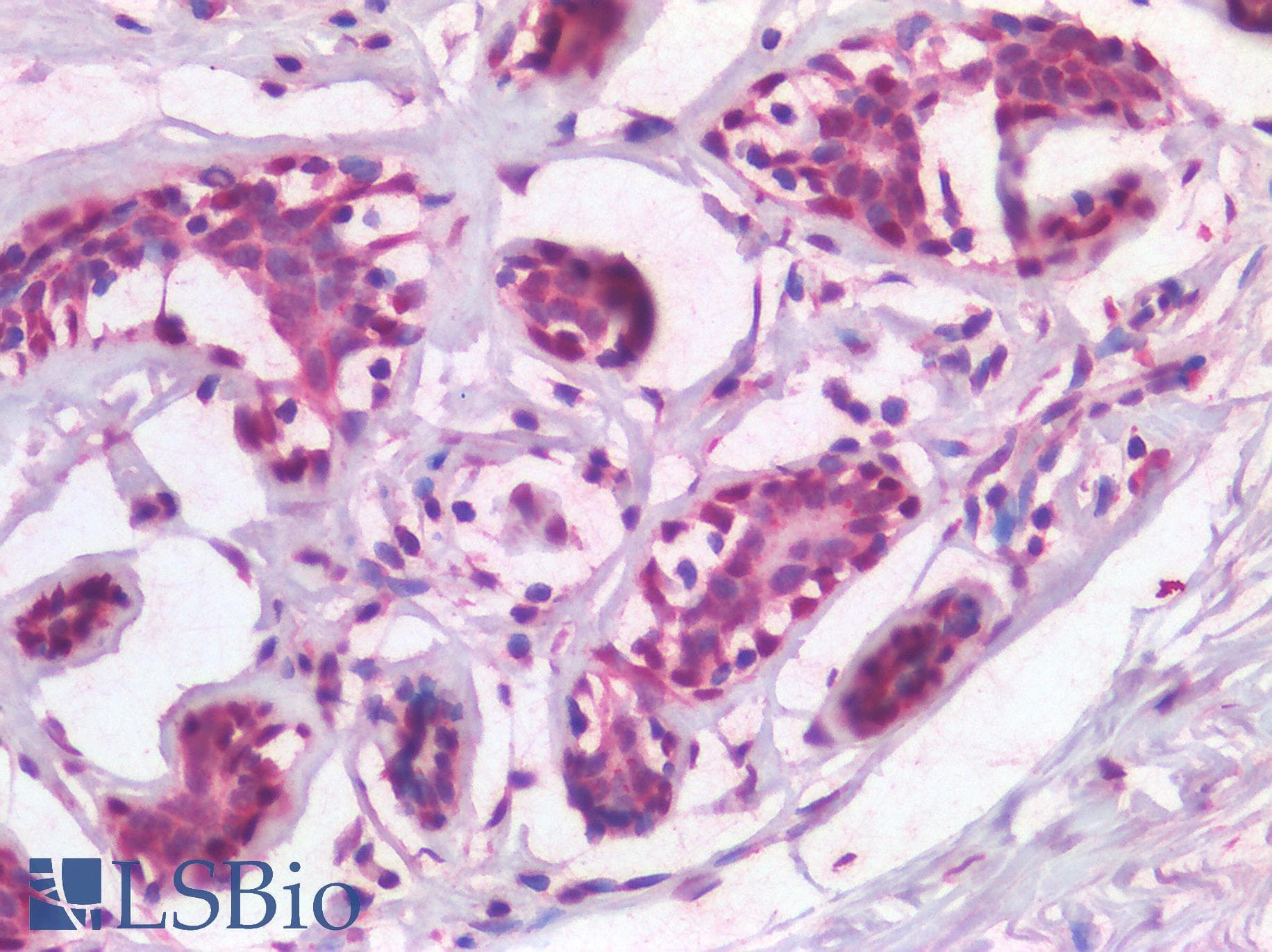 IHC-plus™ TP63 / p63 Antibody