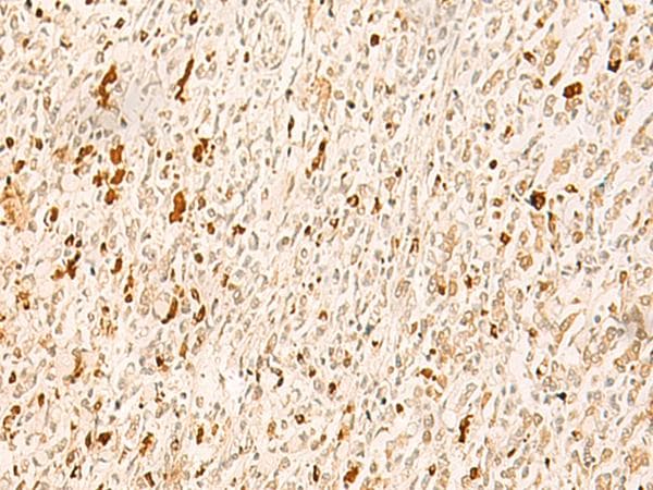 TBPL1 / TRF2 Antibody