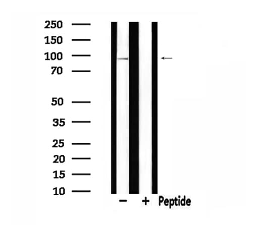 Polyclonal Rabbit anti-Human CDH9 / Cadherin 9 Antibody (IHC, IF, WB)