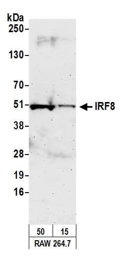 Polyclonal Rabbit anti-Human MRE11A / MRE11 Antibody (aa658-708, IHC, WB)