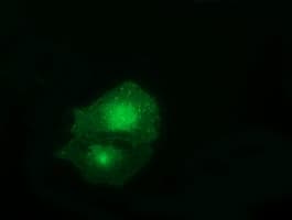 FAM84B Antibody (clone OTI3F12)
