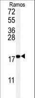 UBE2I / UBC9 Antibody (clone 67AT1273.95.90)
