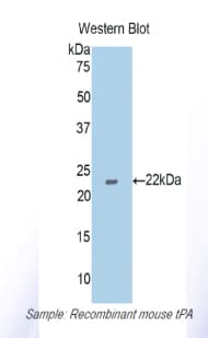 PLAT / TPA Antibody (aa359-532, Cy3)