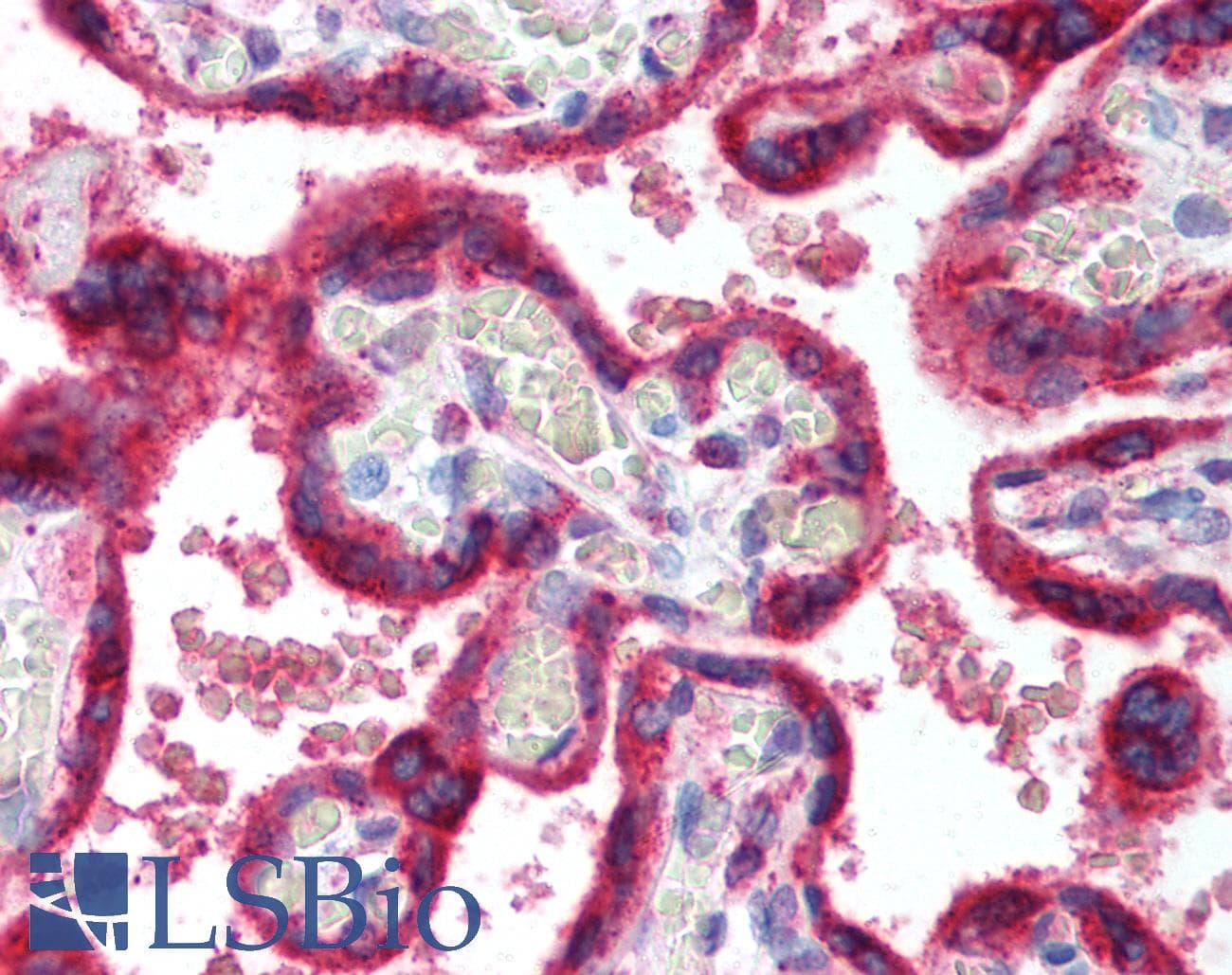 IHC-plus™ HSPA5 / GRP78 / BiP Antibody (aa550-600)