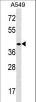 HOXD11 Antibody (aa187-216)