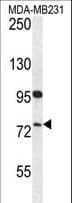 HFM1 Antibody (aa1293-1321)