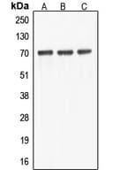Polyclonal Rabbit anti-Human ABCF2 Antibody (Internal, WB)