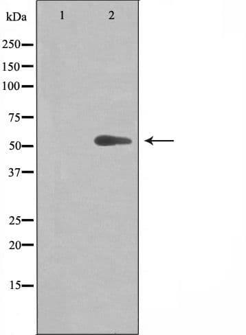CYP-M / CYP20A1 Antibody