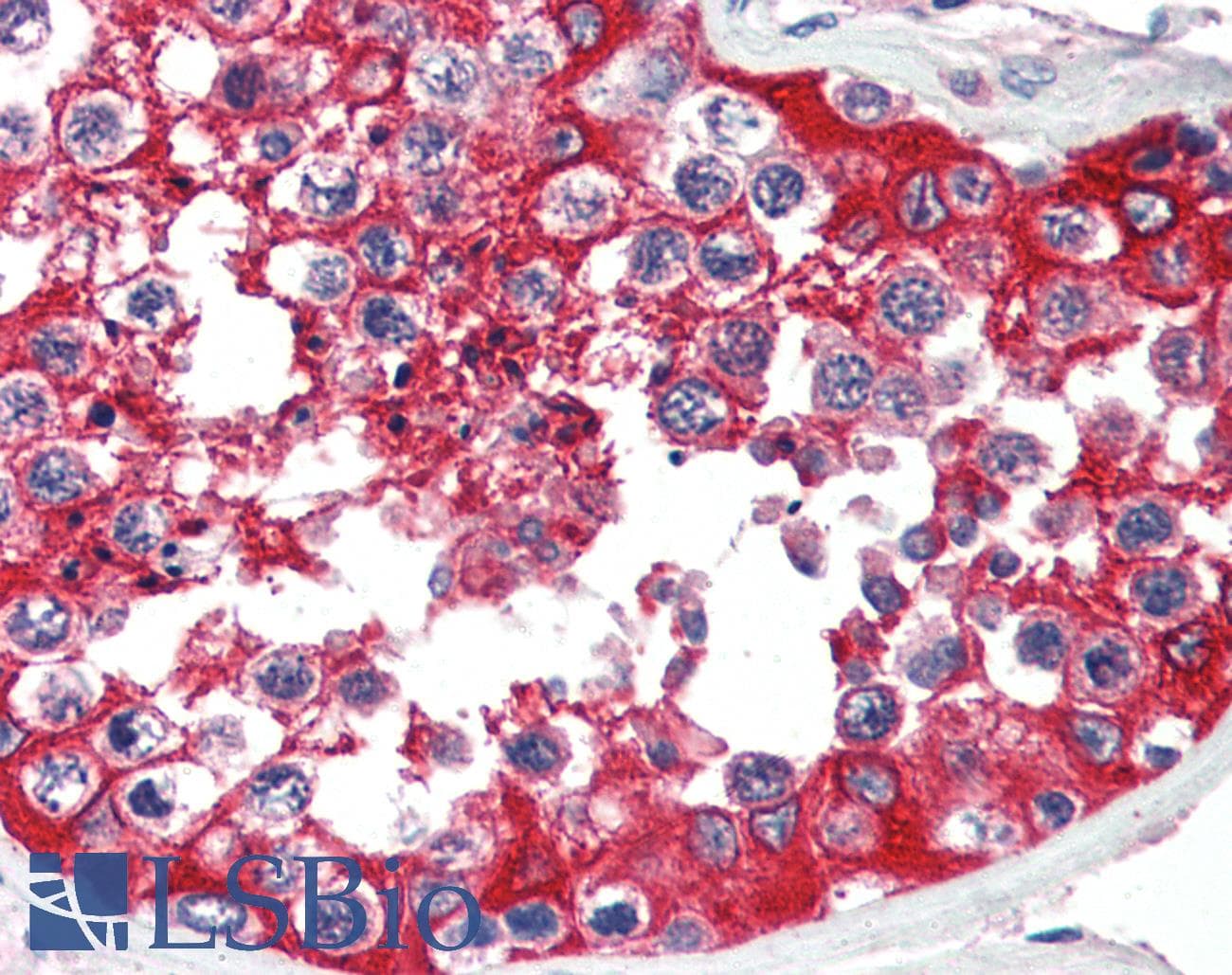 IHC-plus™ G6PD Antibody (aa308-320)
